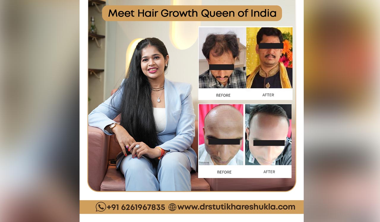 Dr Stuti Khare Shukla transforming lives worldwide through non surgical hair growth treatment