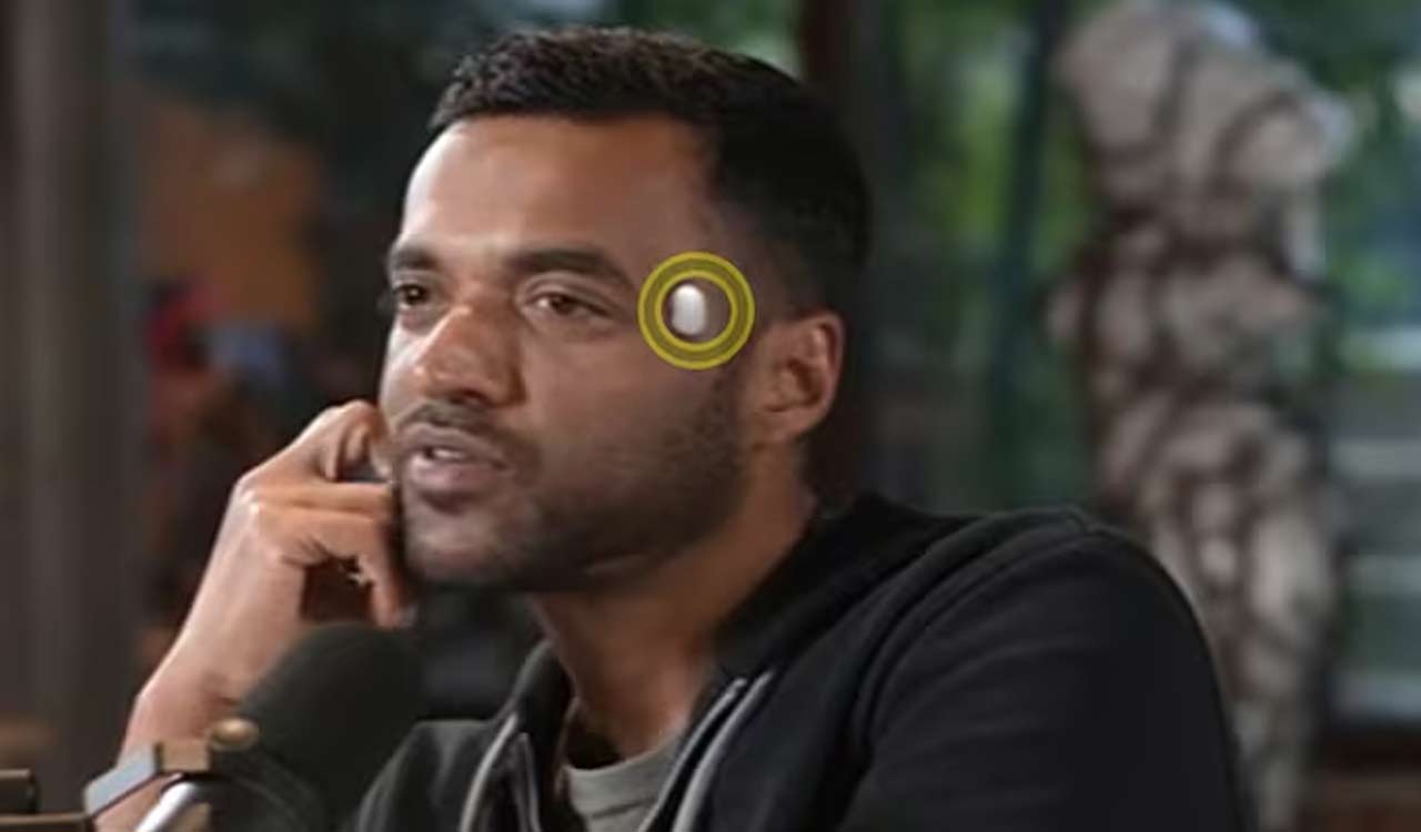 Billionaire’s Toy or Brain Breakthrough? The science behind Deepinder Goyal’s ‘Temple’ wearable