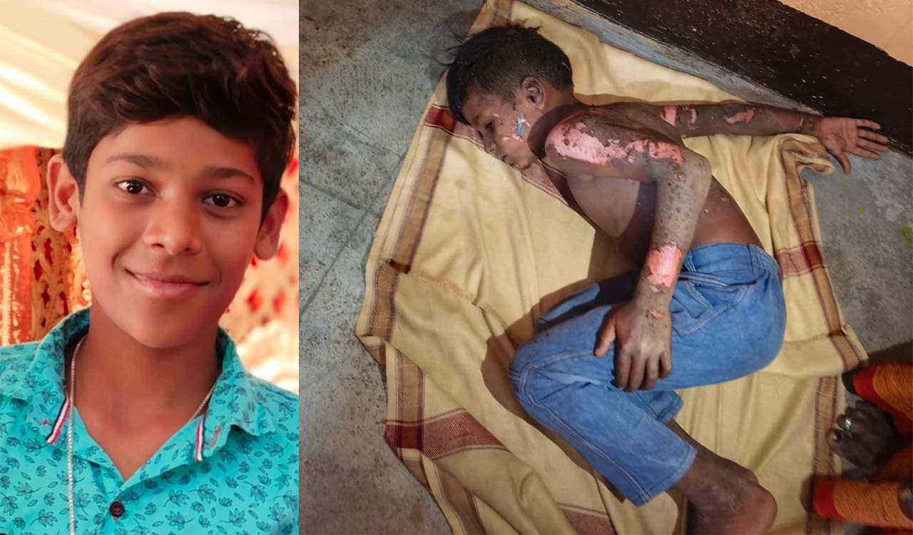 Telangana: Children die after touching nylon manja hanging from power lines