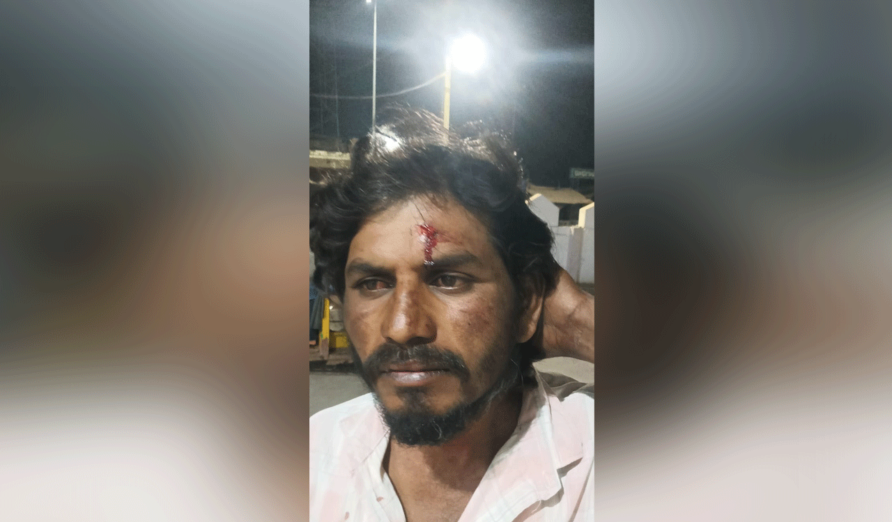 Two BRS leaders injured in stone attack in Chief Minister’s constituency