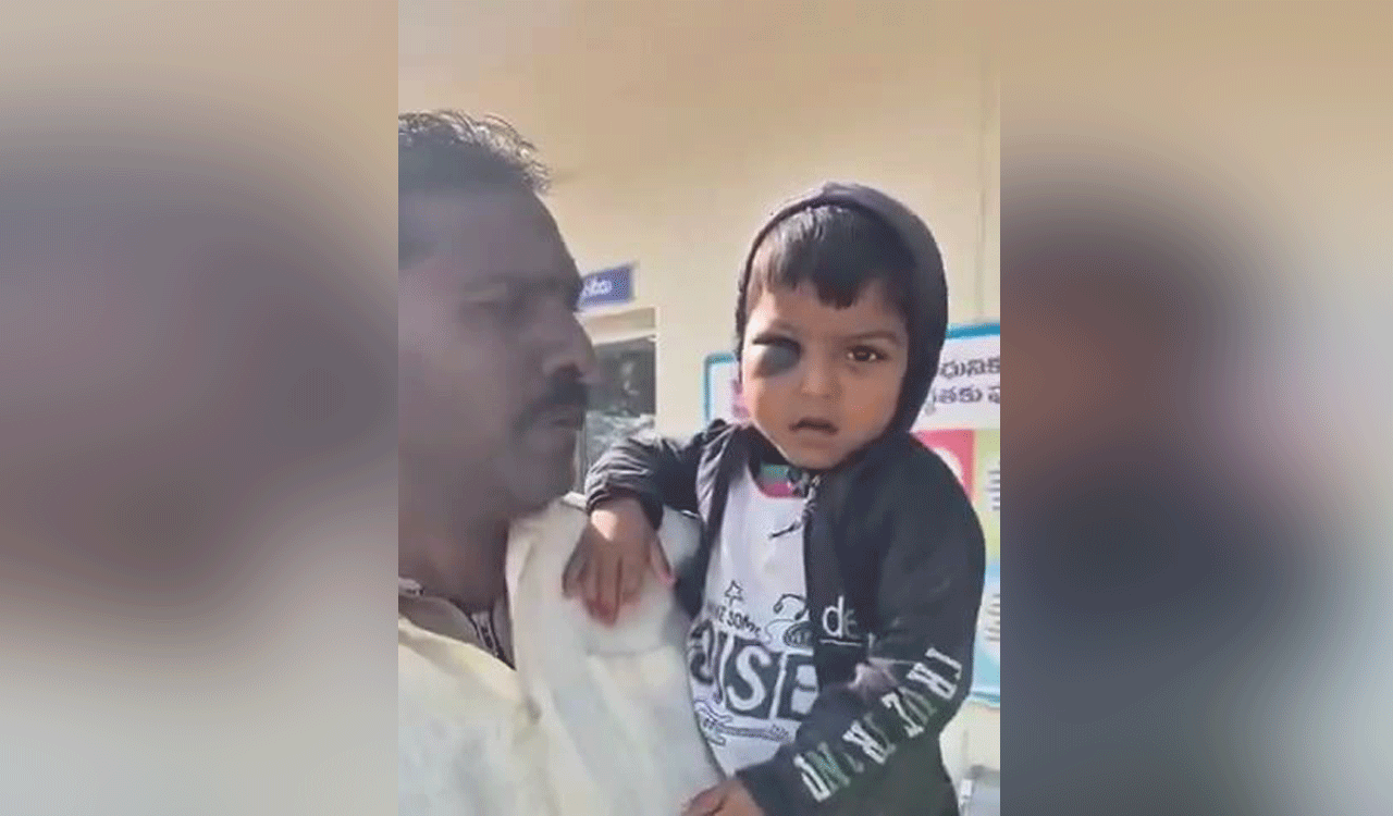 Three-year-old boy thrashed by Anganwadi teacher in Rajanna-Sircilla