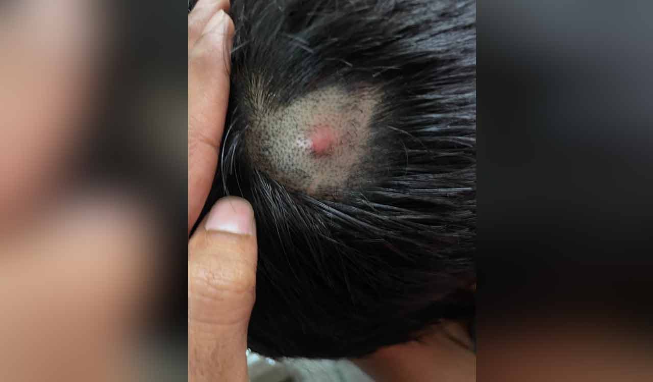 Private school teacher accused of beating student in Zaheerabad