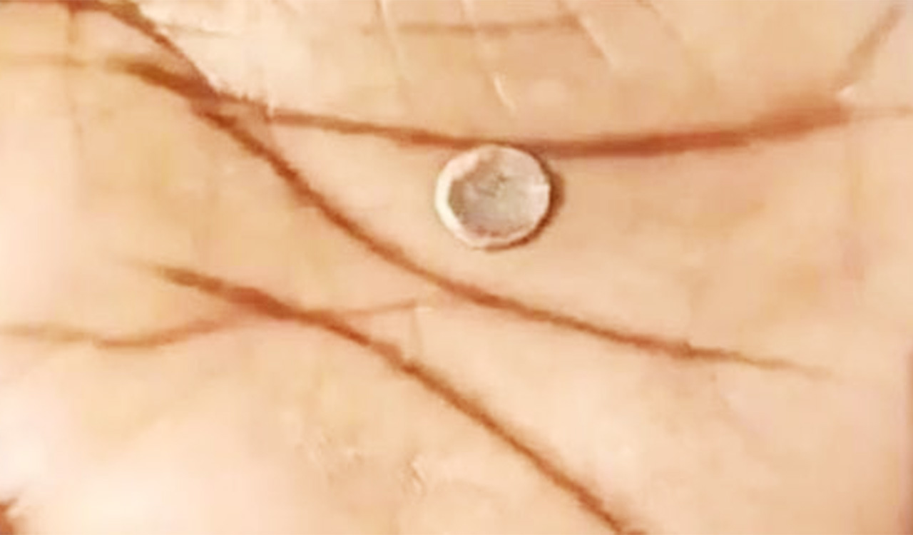 Candidate distributes fake gold coins to lure voters in Sircilla