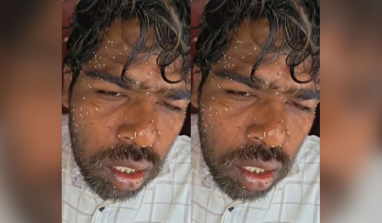 15 injured in honey bee attack in Sangareddy