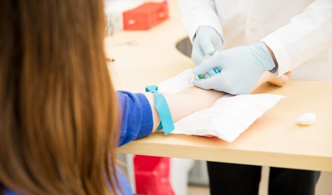 Blood Tests to Consider When Facing Sudden Hair Fall   