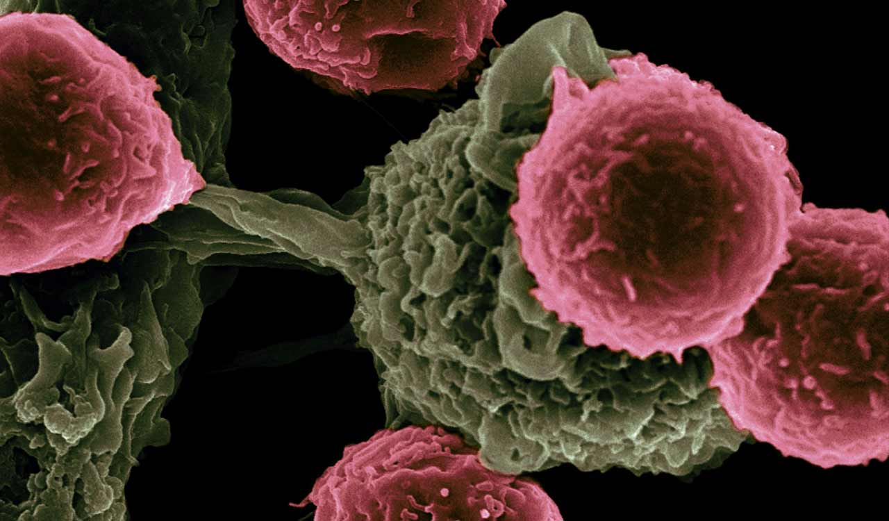 Telangana facing silent crisis of cancer due abysmally low cancer screening