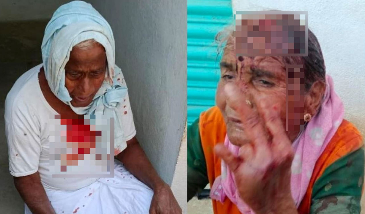 Unidentified miscreants attack elderly couple, decamp with mangalasutra in Medak