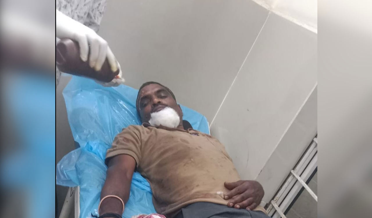 Six injured as RTC bus hits lorry on Rajiv Rahadari near Siddipet