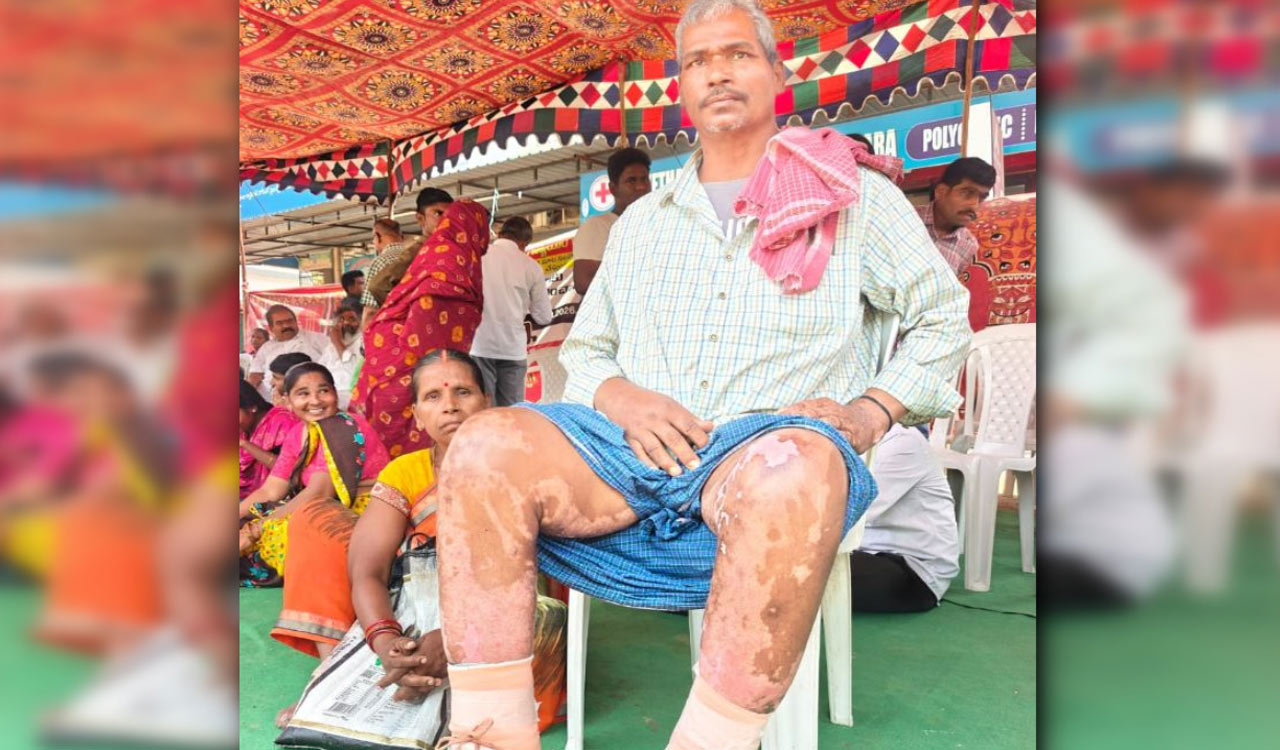 Victims of Sangareddy blast slam Sigachi for denying relief and compensation