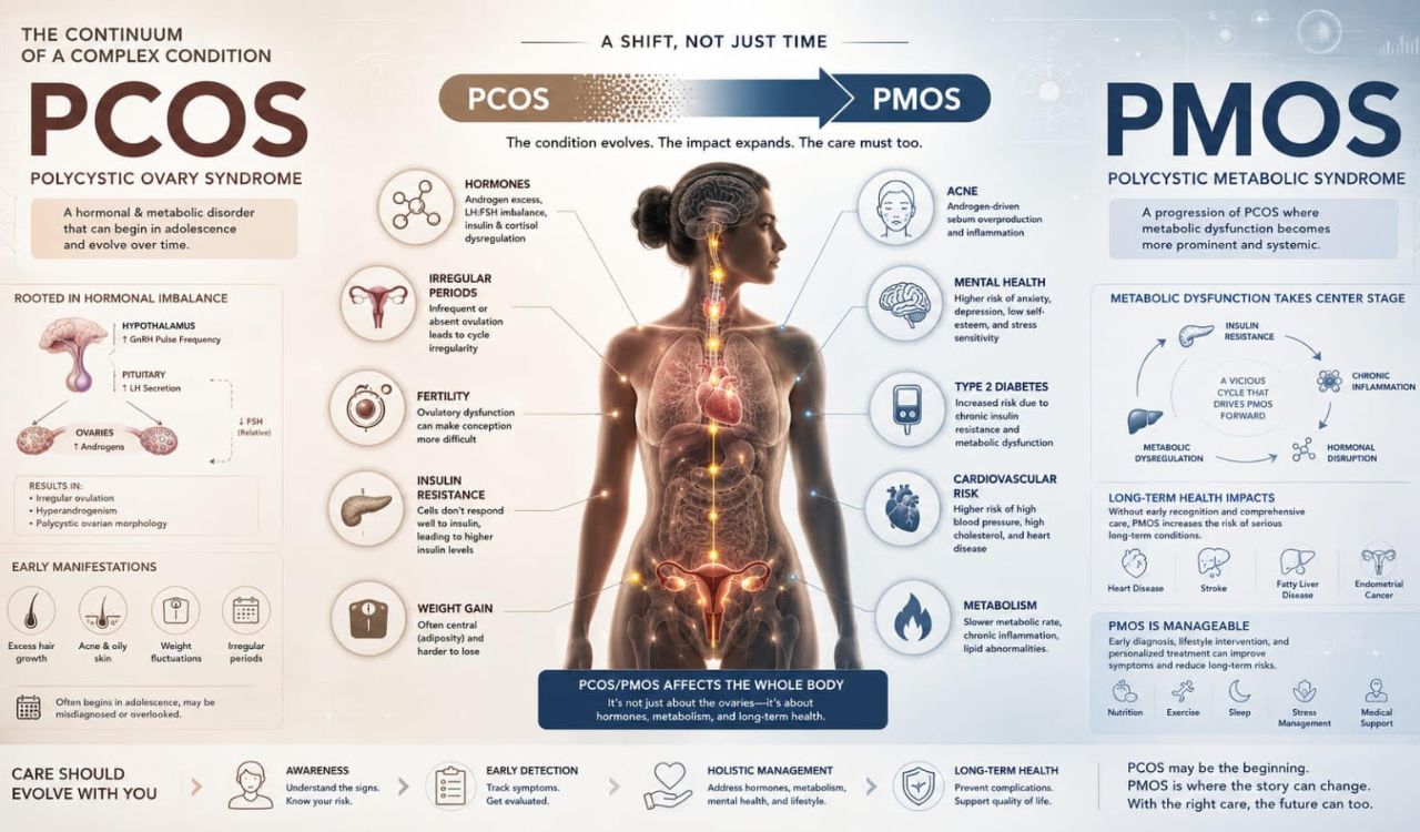 Why Experts Believe PCOS Was Never Just An Ovarian Disorder