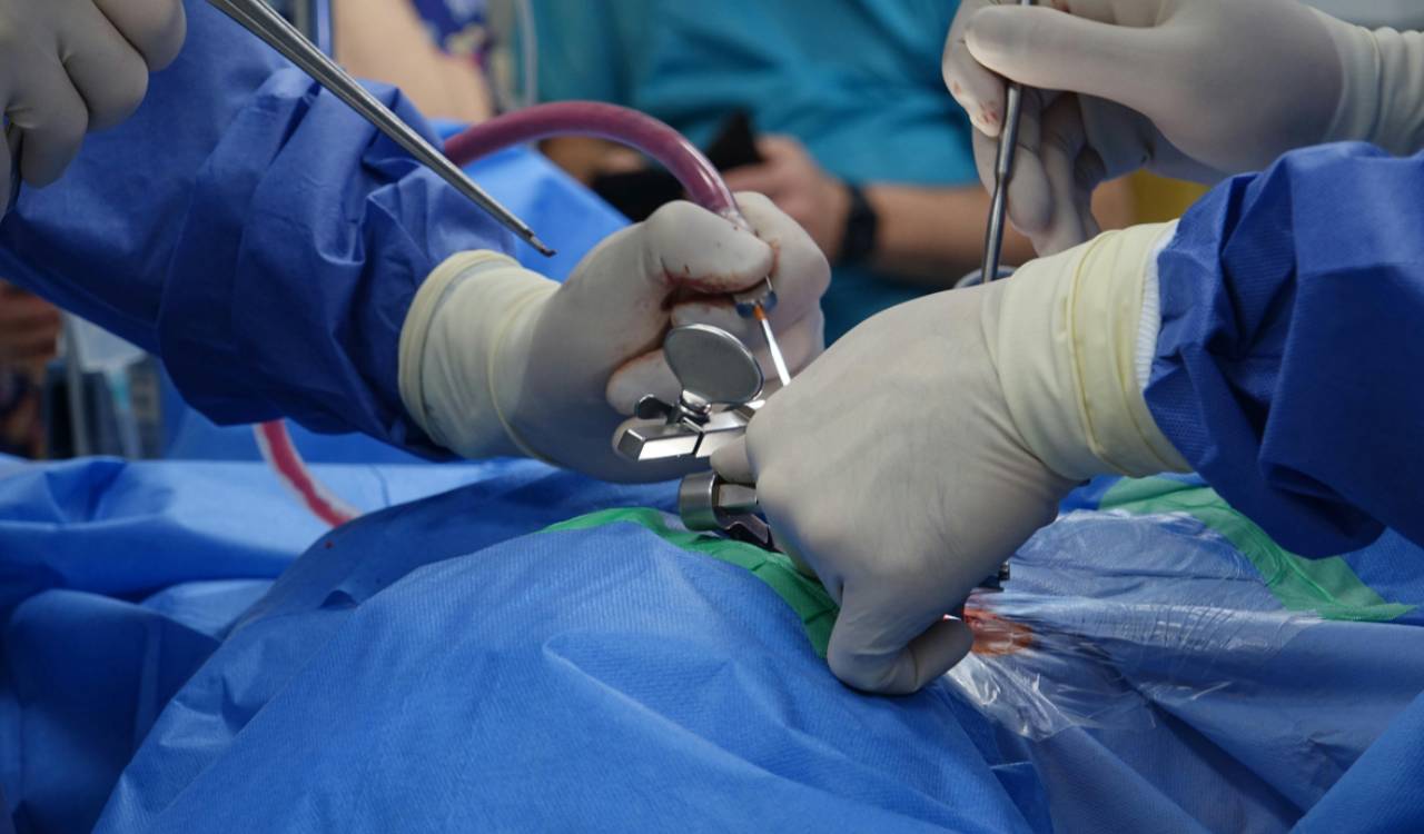 Hyderabad doctors treat scrotal pain with cryoablation, avoid surgery