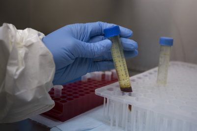 Bengaluru hospital isolates Ugandan woman with Ebola-like symptoms