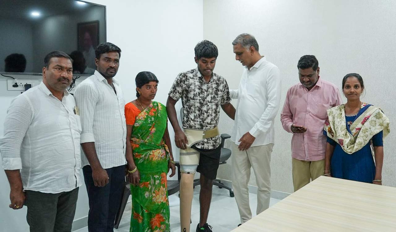 Harish Rao gifts prosthetic leg to Siddipet youth who lost limb in accident