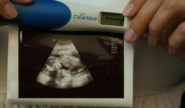 Five women develop kidney failure post‑delivery at Rajasthan’s Bikaner hospital