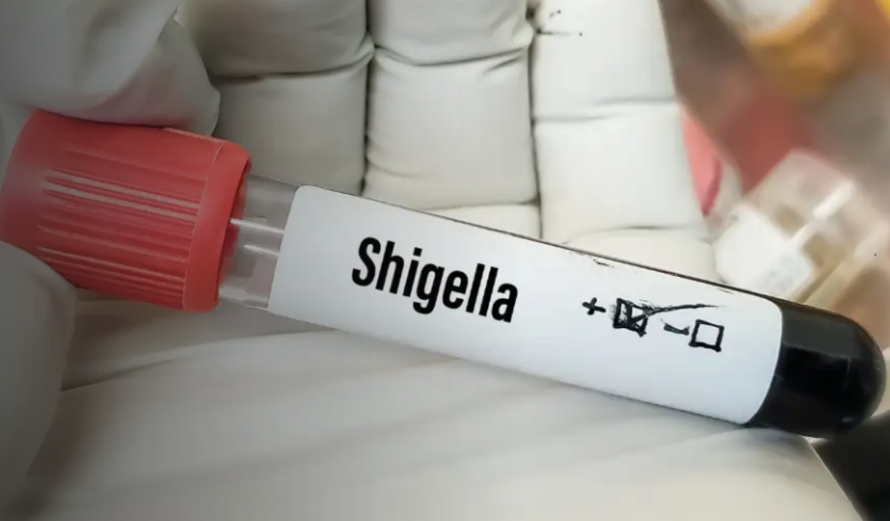 Two Kerala students test positive for Shigella; Kerala on alert as cases emerge across districts