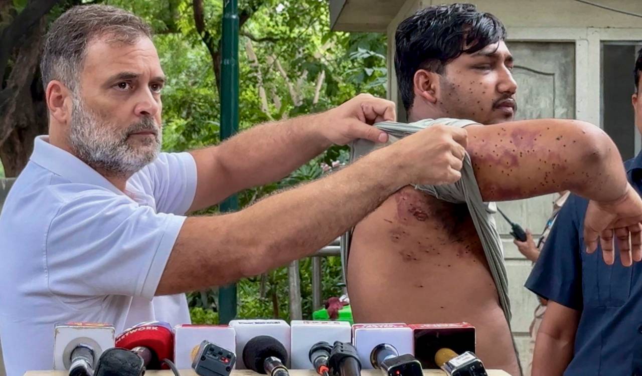 Rahul Gandhi presents student with pellet gun injuries, seeks Pradhan’s removal