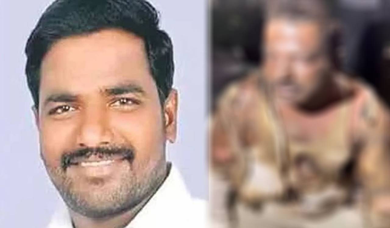Congress leader set ablaze by rowdy sheeter in Warangal dies