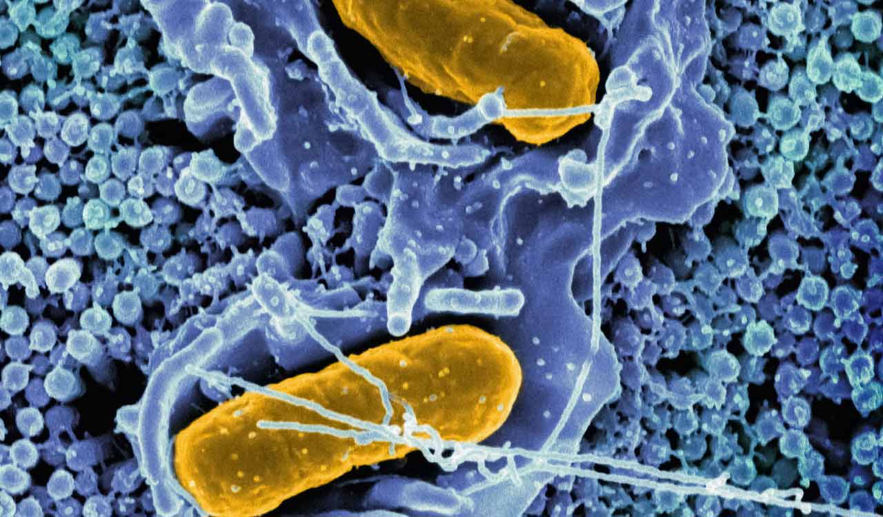 Hyderabad doctors warn Widal test may cause typhoid misdiagnosis amid viral fever surge